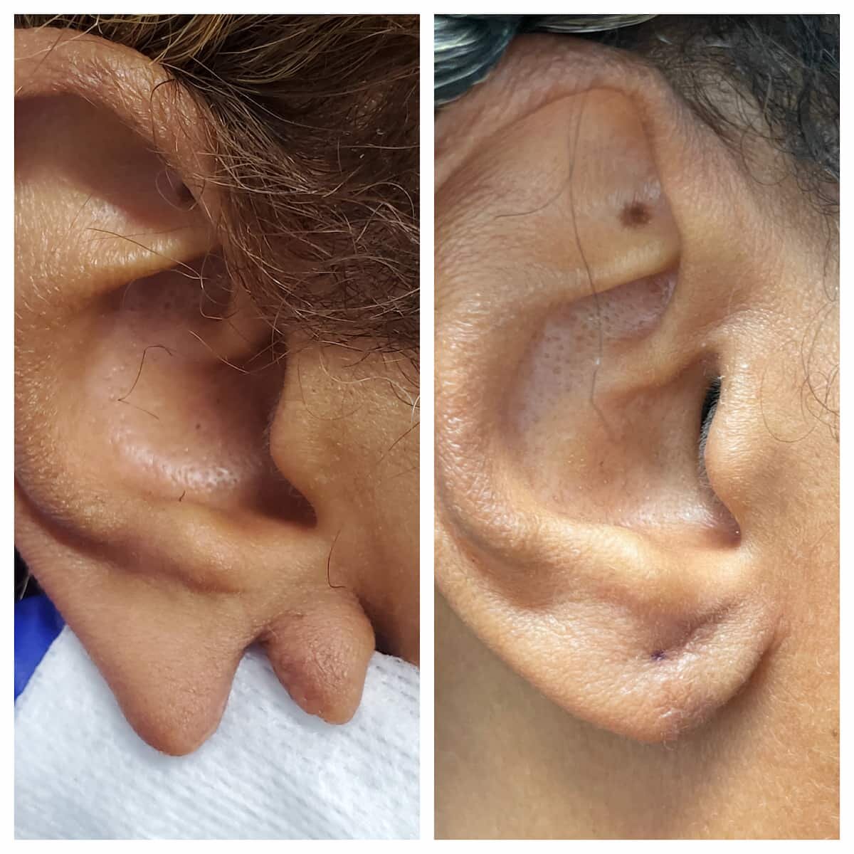 Hole repair on Bab ear : r/buildabear